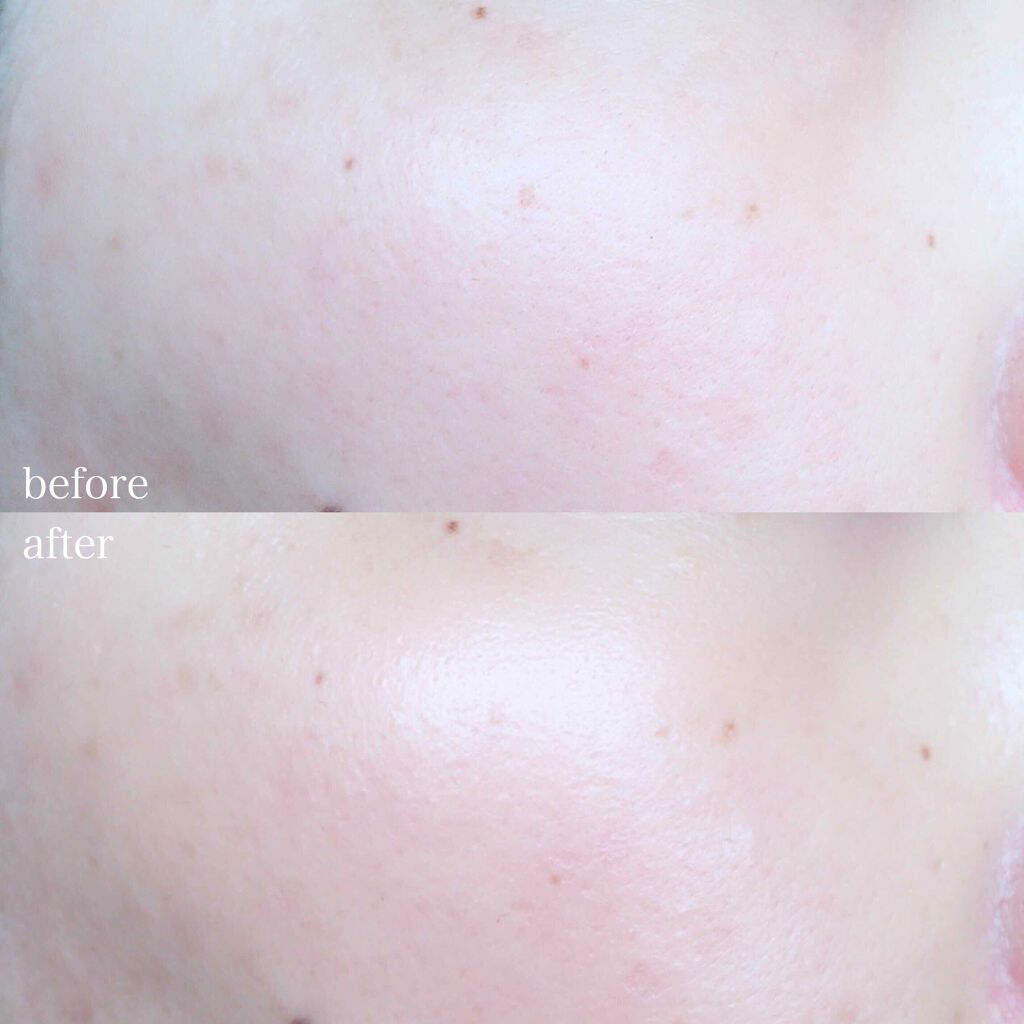 UVã€ã㢠XL ãããã¯ã·ã§ã³ããŒã³ã¢ãã ããŒãº/ã© ããã·ã¥ ããŒ/æ¥çŒãæ¢ãã¯ãªãŒã ã䜿ã£ãã¯ãã³ãïŒ4æç®ïŒ