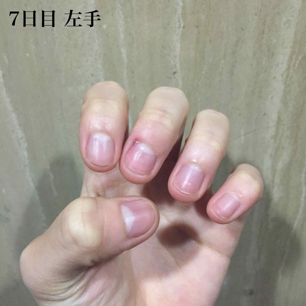 ピンクピンク on LIPS 「みなさんこんにちはこんばんは«爪を噛んでしまう癖をなくそう企画..」(1枚目)