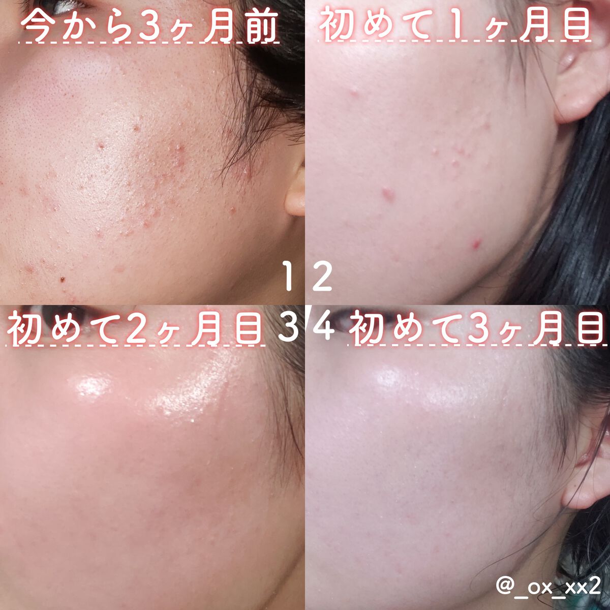 ピュア クレンジング オイル/manyo/オイルクレンジングを使ったクチコミ（2枚目）