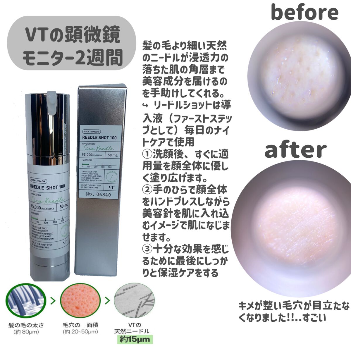 リードルショット100/VT/美容液を使ったクチコミ(2枚目)