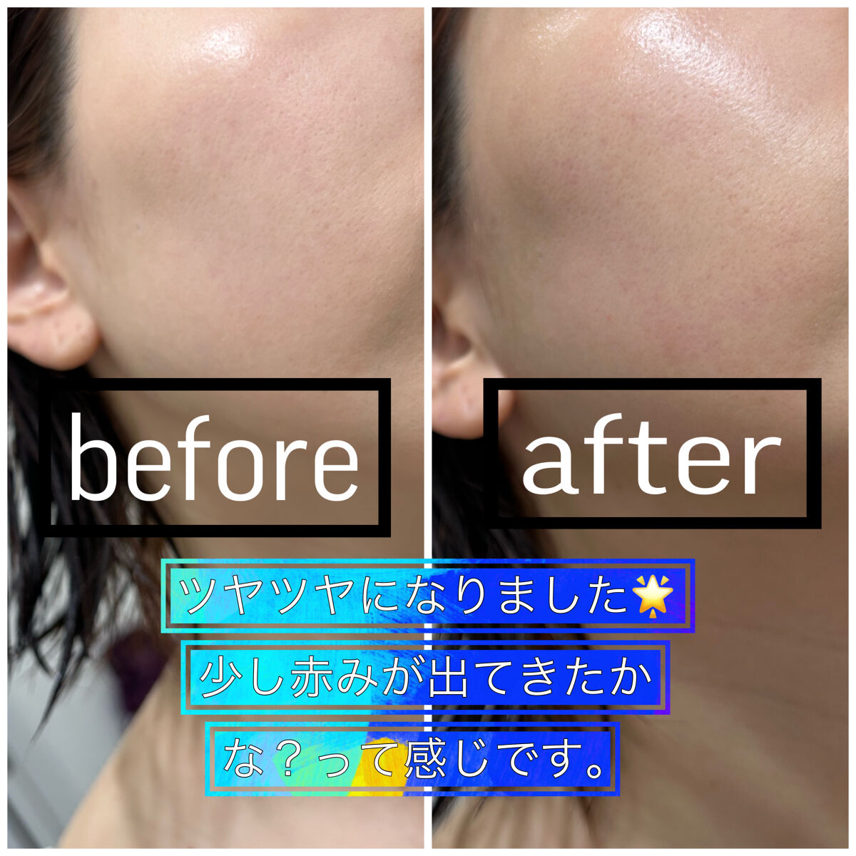 レチノールインテンシブ アドバンスドトリプルアクションアイクリーム/SOME BY MI/アイケア・アイクリームを使ったクチコミ（3枚目）