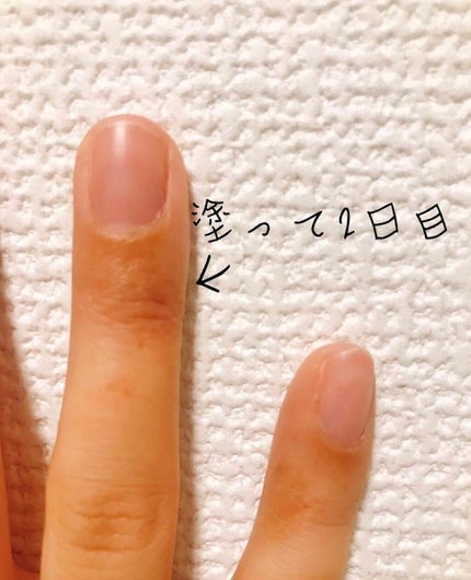 ヒリギレ軟膏(医薬品)/ムヒ/その他を使ったクチコミ(6枚目)