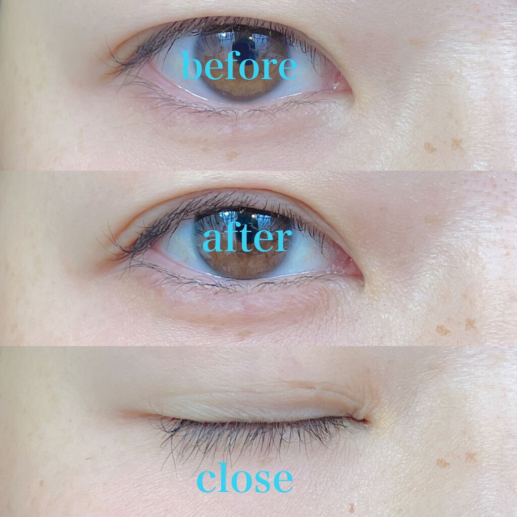 TWOOL ダブルアイリッドグルー/SHOBIDO/二重まぶた用アイテムを使ったクチコミ(2枚目)