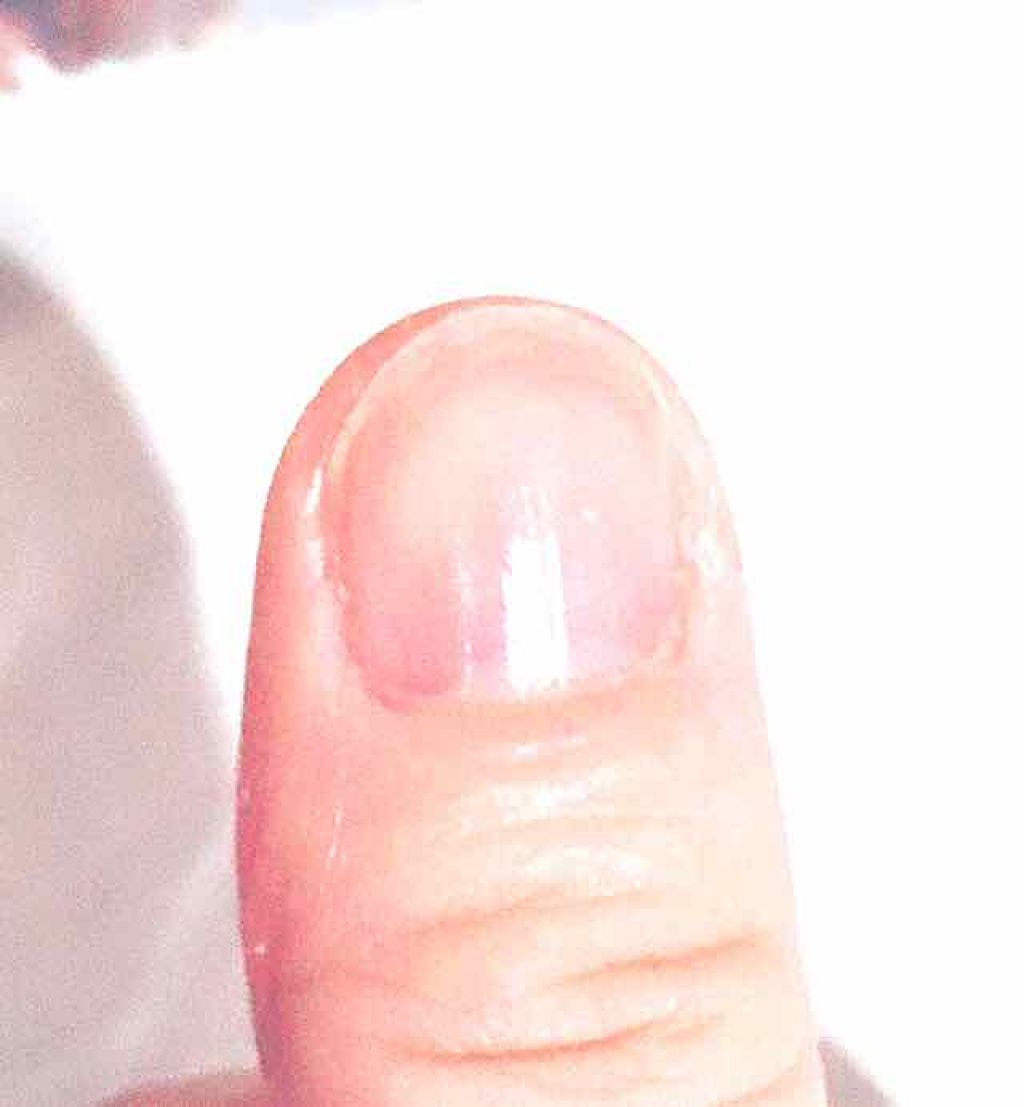 エテュセ クイックケアコート/ettusais/ネイルオイル・トリートメントを使ったクチコミ(2枚目)