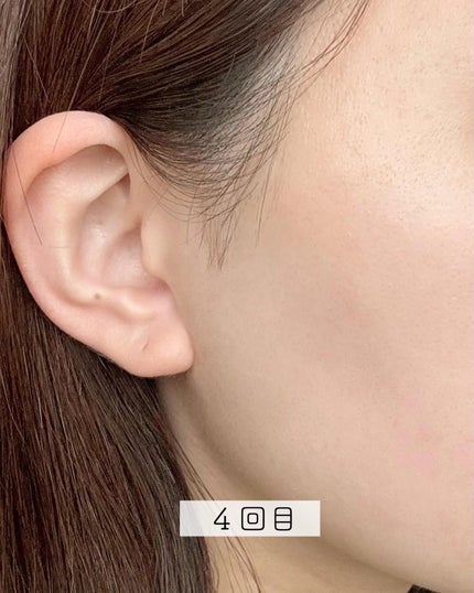 MiRAY/MYTREX/美顔器・マッサージを使ったクチコミ(5枚目)