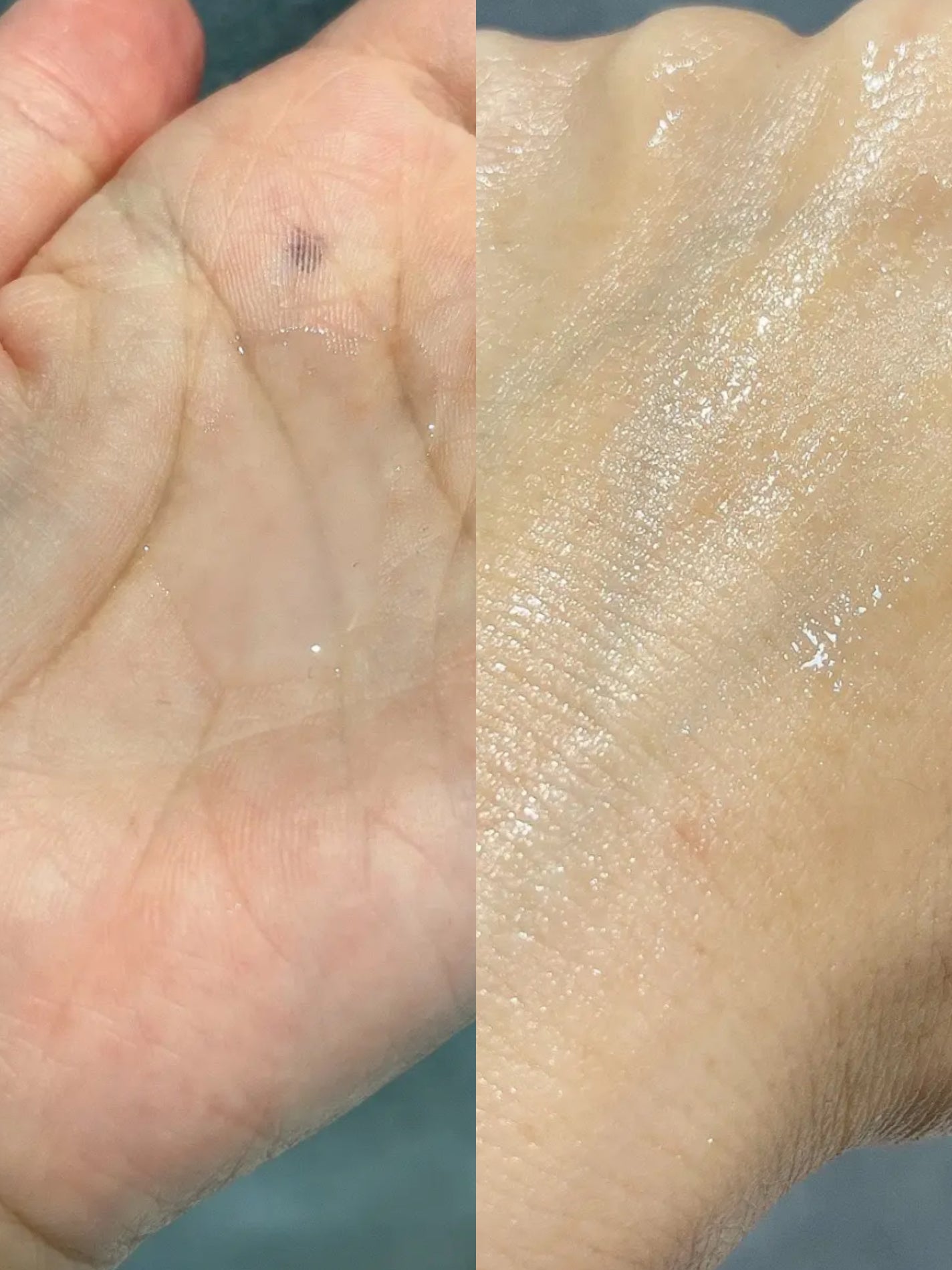 グルタチオンアンプルトナー/SKIN&LAB/化粧水を使ったクチコミ(3枚目)