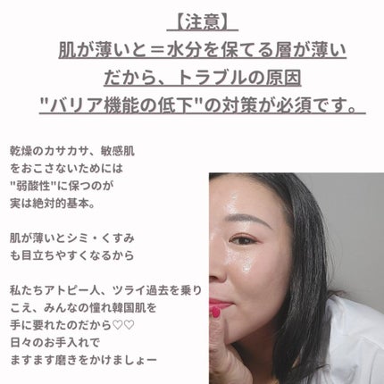 美肌カウンセラー💆肌悩みを解決し見る世界を変える on LIPS 「アトピーを乗りこえた先にある"誰もが手に入れたい陶器肌"それを..」(8枚目)