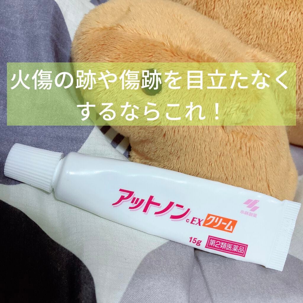 アットノンEX クリーム(医薬品)/アットノン/その他を使ったクチコミ(1枚目)