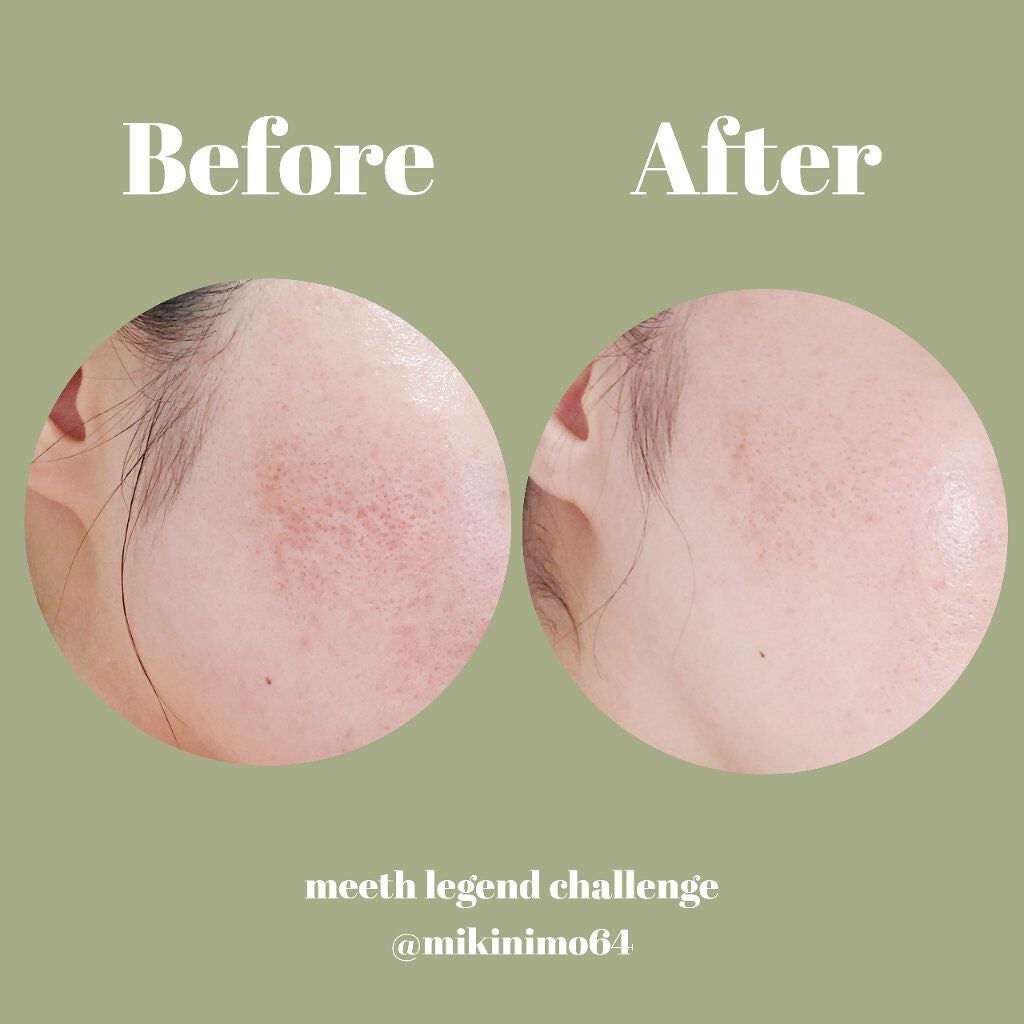 モアリッチパック/meeth/シートマスク・パックを使ったクチコミ(2枚目)