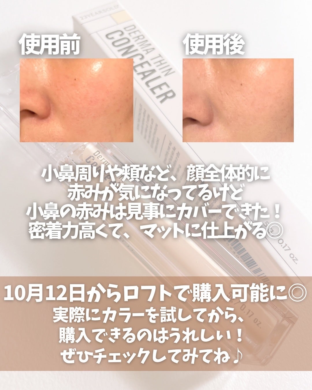 ダーマシンコンシーラー/23years old/リキッドコンシーラーを使ったクチコミ(4枚目)