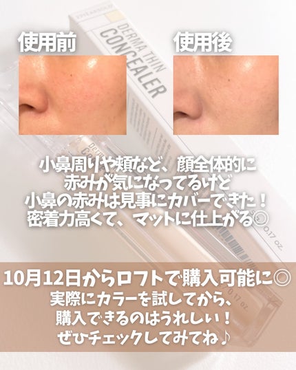 ダーマシンコンシーラー/23years old/リキッドコンシーラーを使ったクチコミ(4枚目)