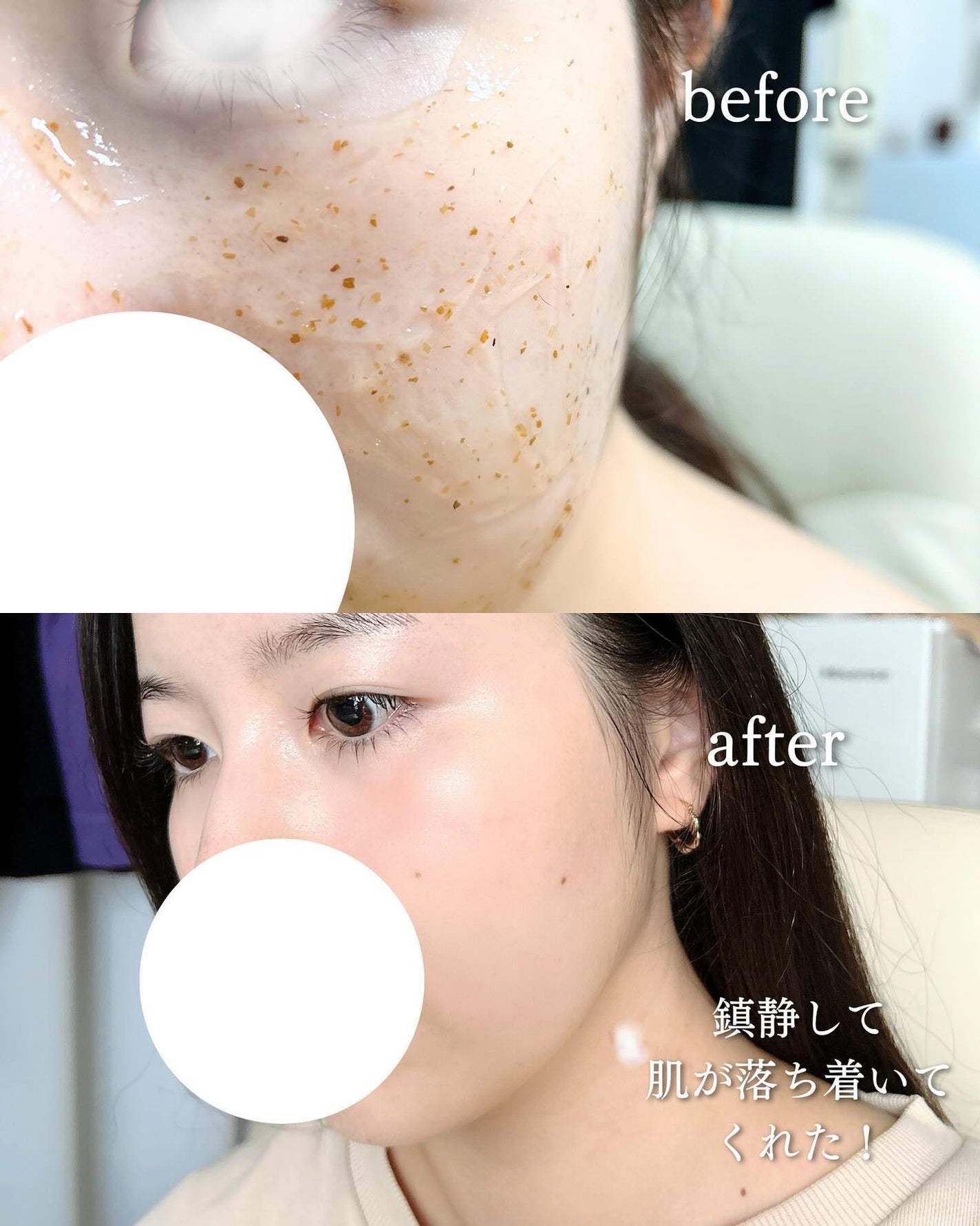 リアルシカペストパック/ビューランチ/洗い流すパック・マスクを使ったクチコミ(4枚目)