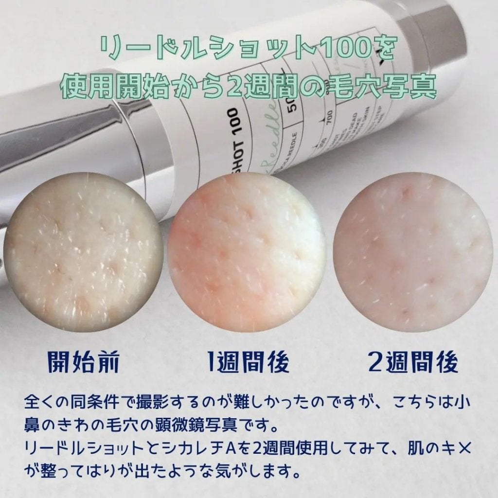 CICA クリーム/VT/フェイスクリームを使ったクチコミ(6枚目)