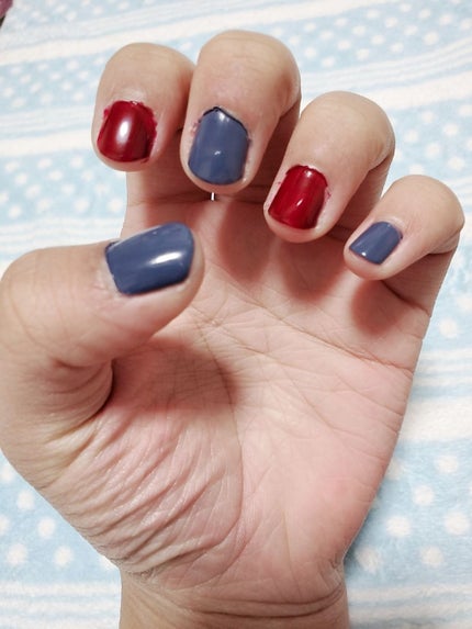 リップパック /CHOOSY/リップマスクを使ったクチコミ(2枚目)