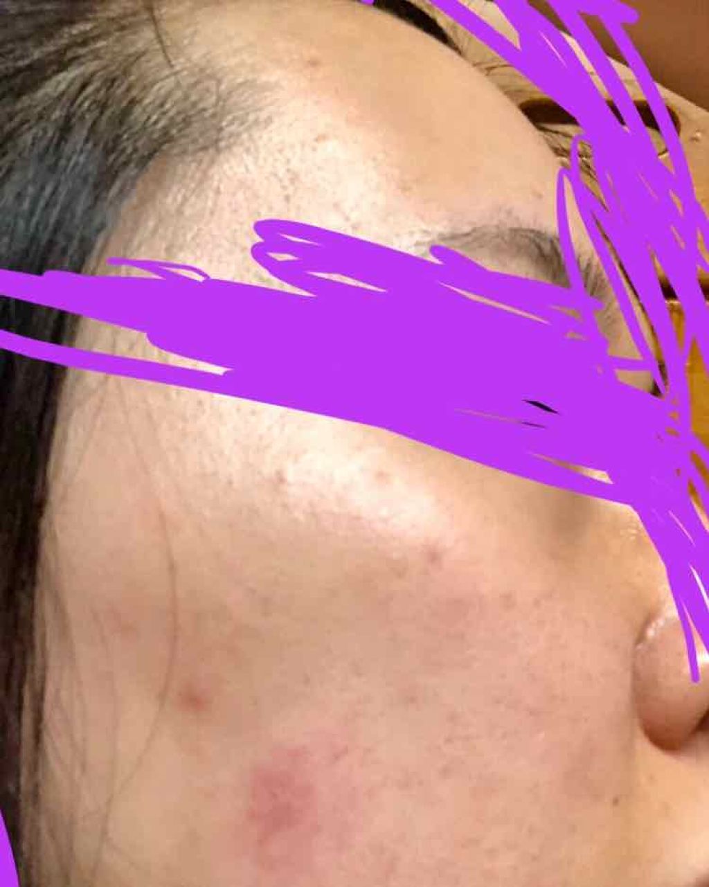 アクネケア おためしキット/ファンケル/トライアルキットを使ったクチコミ(2枚目)