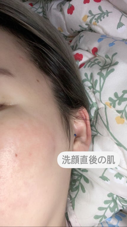 ザビタミンC23/IOPE/美容液を使ったクチコミ(2枚目)