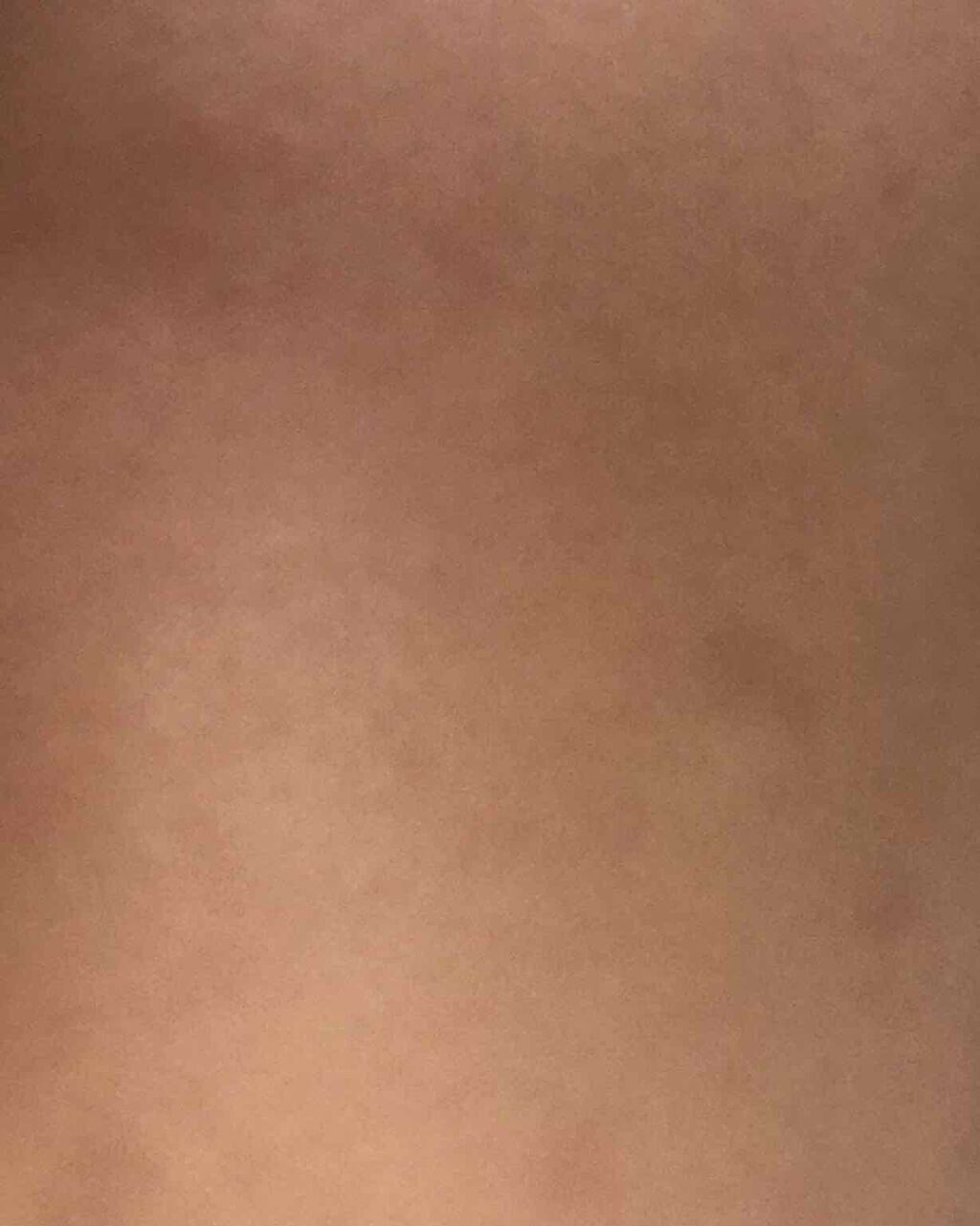 ロゼット洗顔パスタ アクネクリア/ロゼット/洗顔フォームを使ったクチコミ（1枚目）