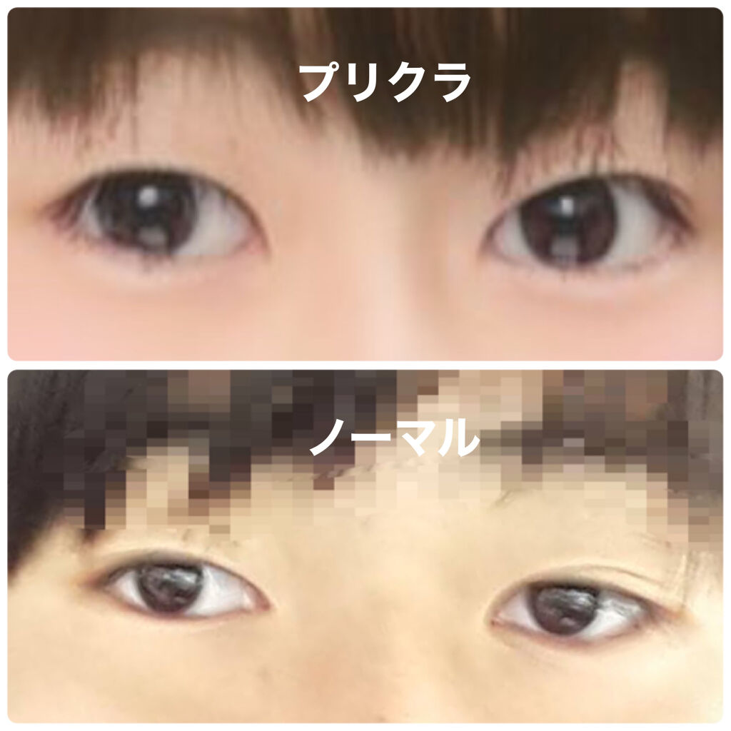 のびーるアイテープ（絆創膏タイプ、レギュラー）/DAISO/二重まぶた用アイテムを使ったクチコミ（2枚目）