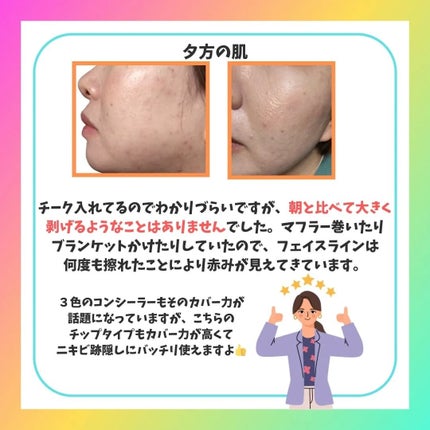 アイドルカバーコンシーラー/TFIT/リキッドコンシーラーを使ったクチコミ(5枚目)