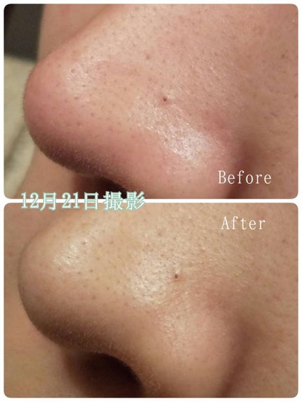 パワーマスク SP/ラッシュ/スクラブ・ゴマージュを使ったクチコミ(6枚目)