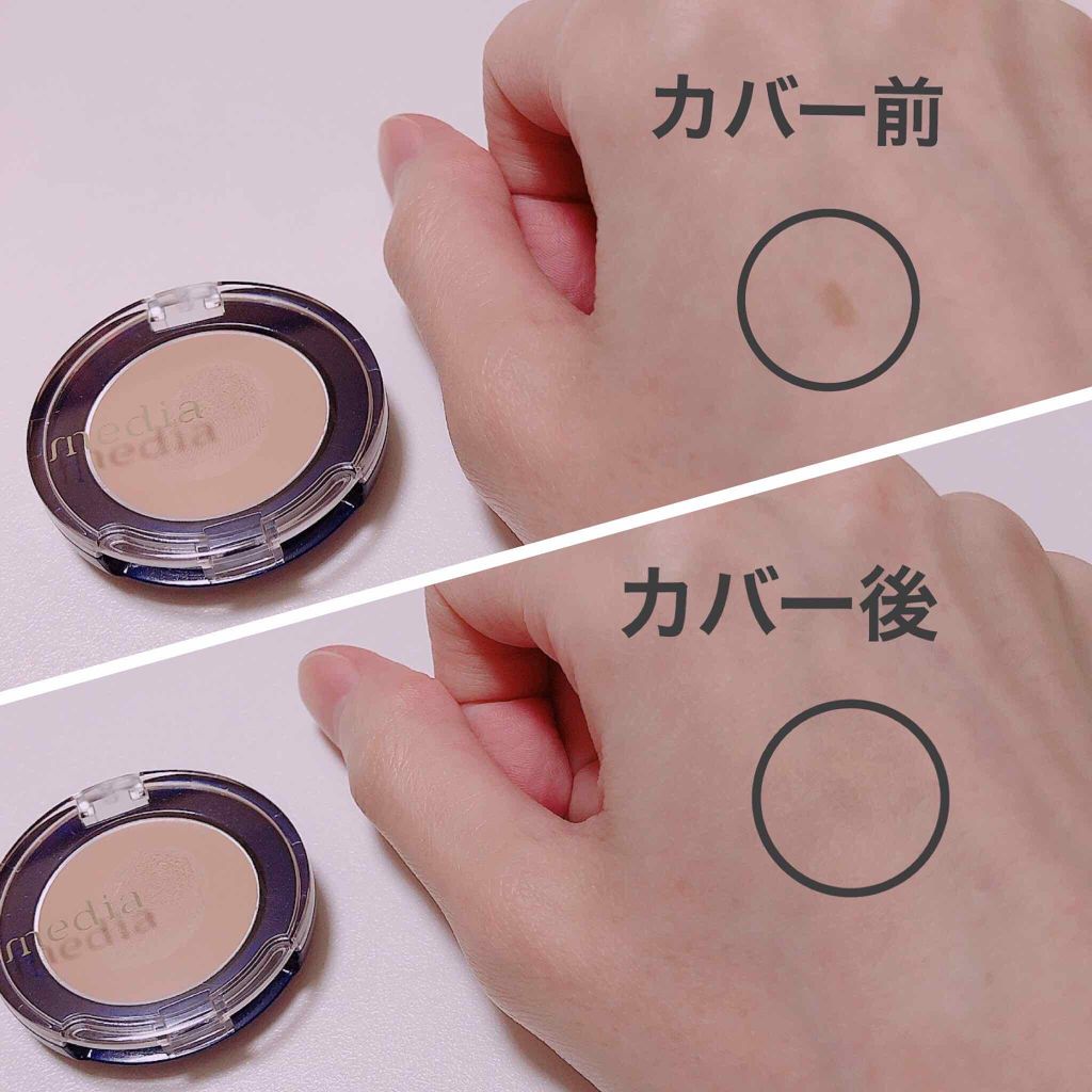 コンシーラーS/media/クリームコンシーラーを使ったクチコミ（3枚目）