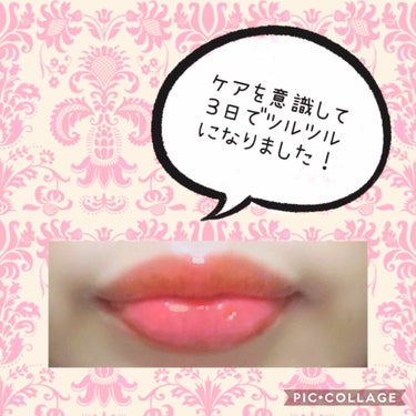 シルベーヌ on LIPS 「秋深し。私の唇に入ったヒビも深し。。これはダメだー！！！！😱と..」（3枚目）