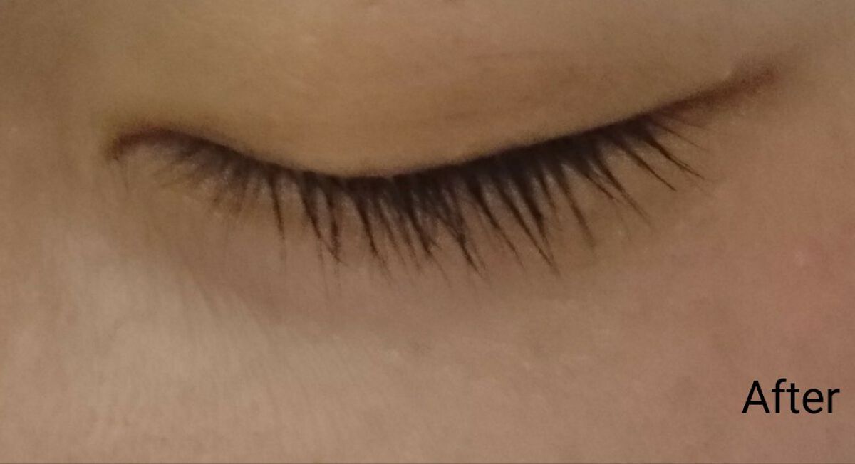 ALL-J モイストリッチアイ マルチVコンセントレイト/ALL-J/アイケア・アイクリームを使ったクチコミ(4枚目)