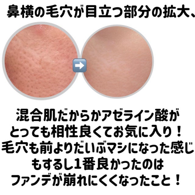 A1カーミング アンプル/VT/美容液を使ったクチコミ(7枚目)