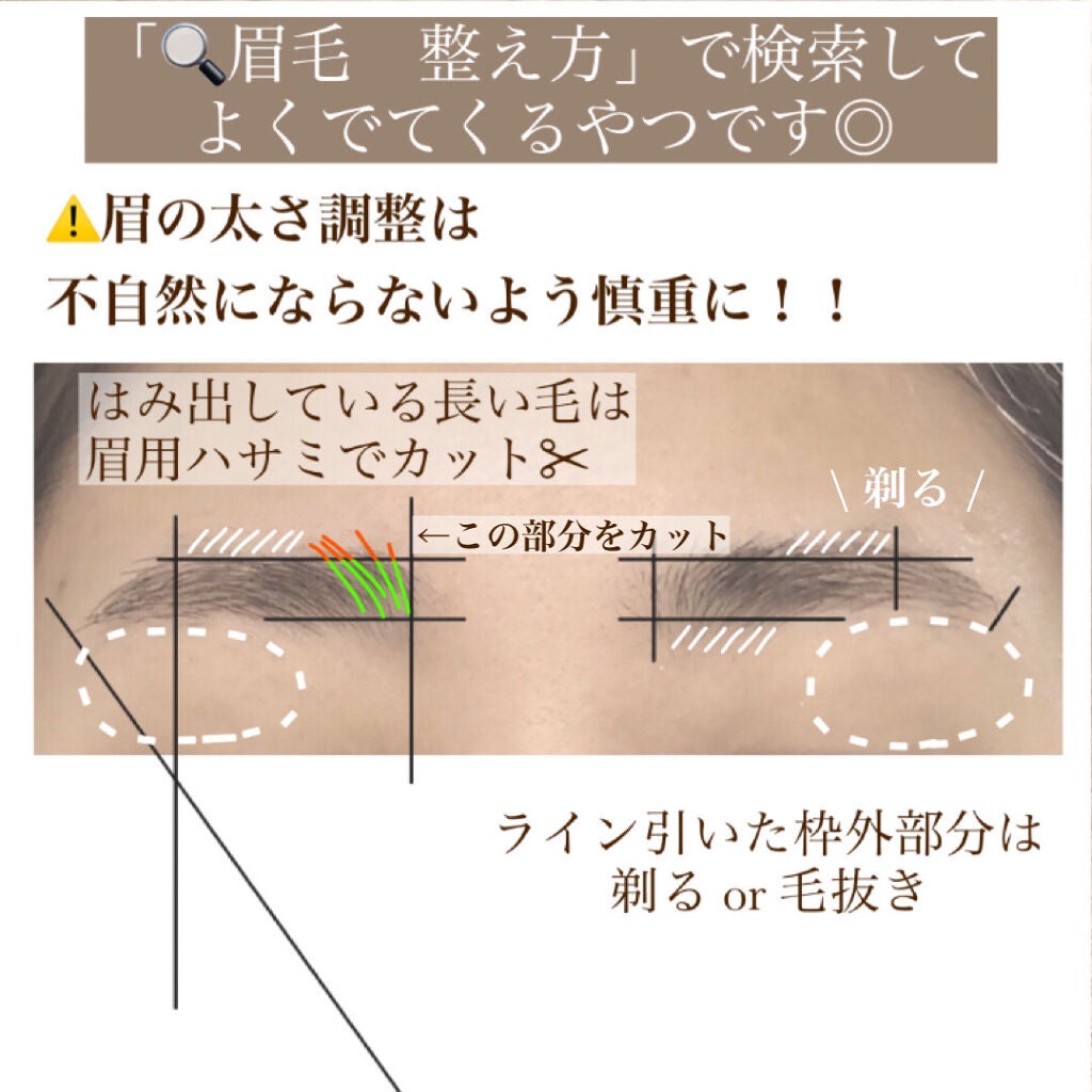 プレミア敏感肌用 Lディスポ/シック/シェーバーを使ったクチコミ(4枚目)