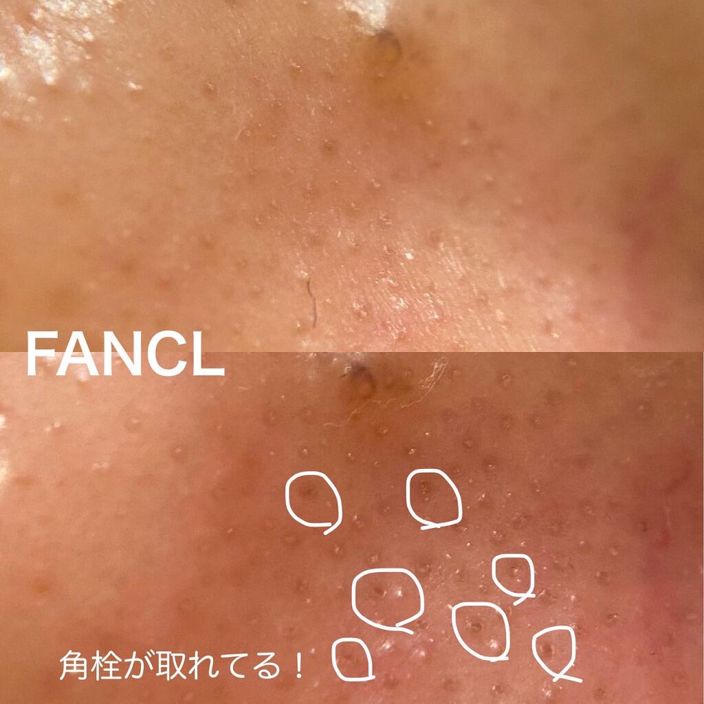 ディープクリア洗顔パウダー/ファンケル/洗顔パウダーを使ったクチコミ(5枚目)