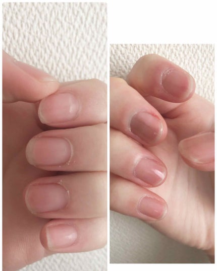 エテュセ クイックケアコート/ettusais/ネイルオイル・トリートメントを使ったクチコミ(4枚目)