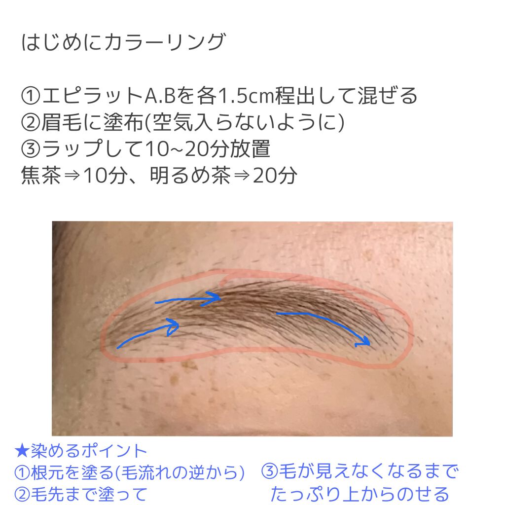 脱色クリーム スピーディー/エピラット/ムダ毛ケアを使ったクチコミ（3枚目）