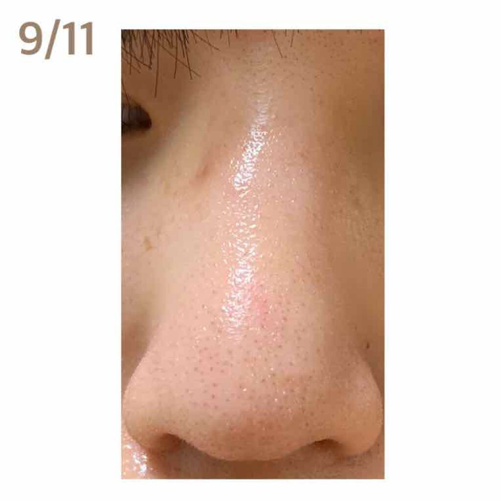 ジョンソンベビーオイル微香性/ジョンソンベビー/ボディオイルを使ったクチコミ（2枚目）