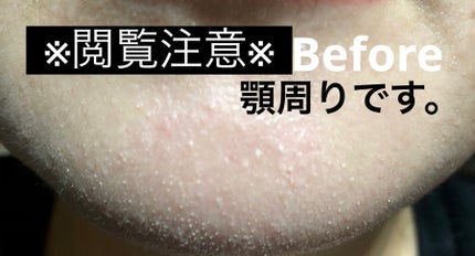 クリーンイットゼロ クレンジングバーム ポアクラリファイング/BANILA CO/クレンジングバームを使ったクチコミ(4枚目)