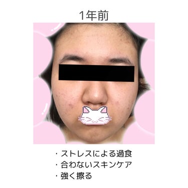 泡洗顔 コントロールケア/ビフェスタ/洗顔フォームを使ったクチコミ（3枚目）