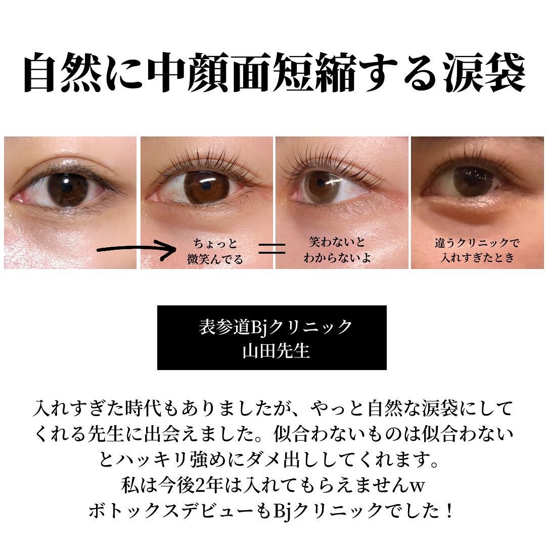 miriïŒã¿ãïŒðŒ on LIPS ãä»å¹Žãã£ãŠè¯ãã£ãçŸå®¹å»çïŒãããããšãäžè©±ã«ãªããŸããðå³..ãïŒ4æç®ïŒ