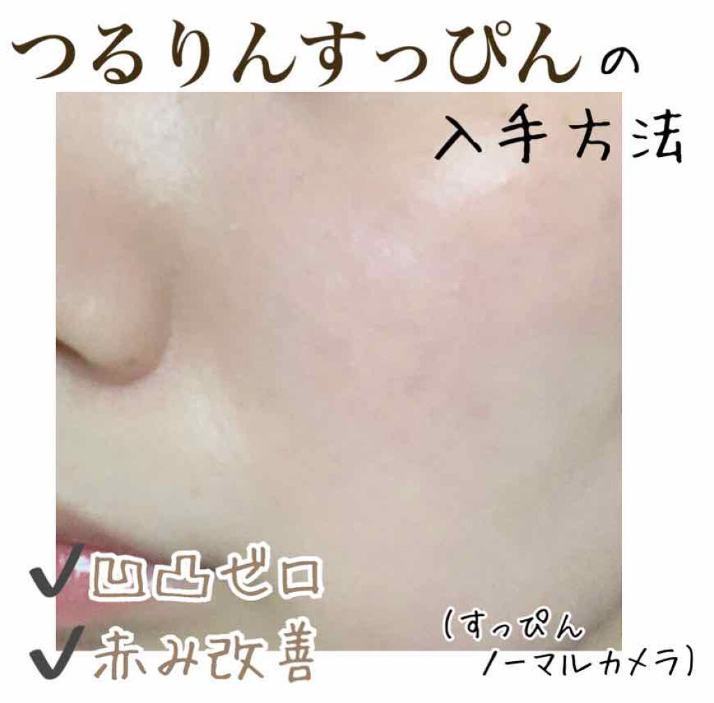 ペアアクネクリームW(医薬品)/ペア/その他を使ったクチコミ（1枚目）