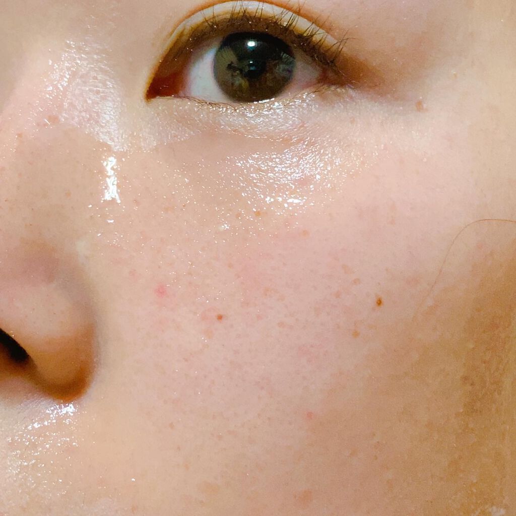 ももぷり フレッシュピールオフパック/ももぷり/ピーリングを使ったクチコミ（3枚目）