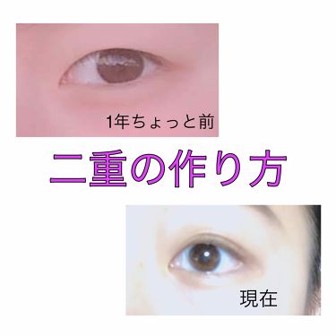 のび る アイテープ 絆創膏タイプ Daisoの口コミ 超優秀 100均で買えるおすすめ二重まぶた用アイテム 目のアップ写真ありま By ぽりぶくろ 混合肌 10代後半 Lips