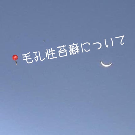 ハトムギ保湿ジェル(ナチュリエ スキンコンディショニングジェル)/ナチュリエ/美容液を使ったクチコミ(1枚目)