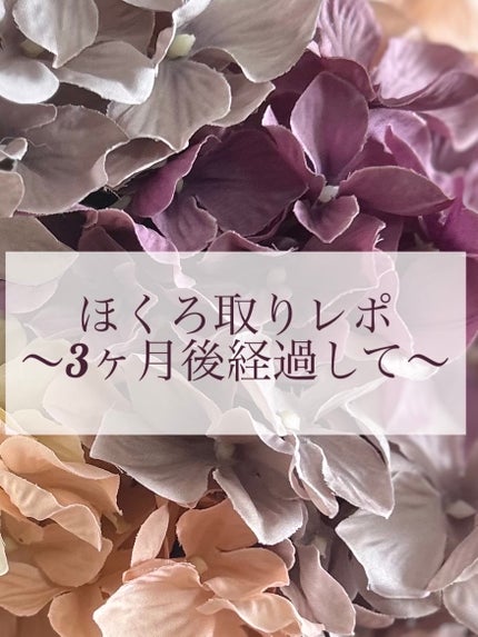 セノ on LIPS 「ほくろ取りして3ヶ月経ちましたので経過報告です!日焼けに注意し..」(1枚目)