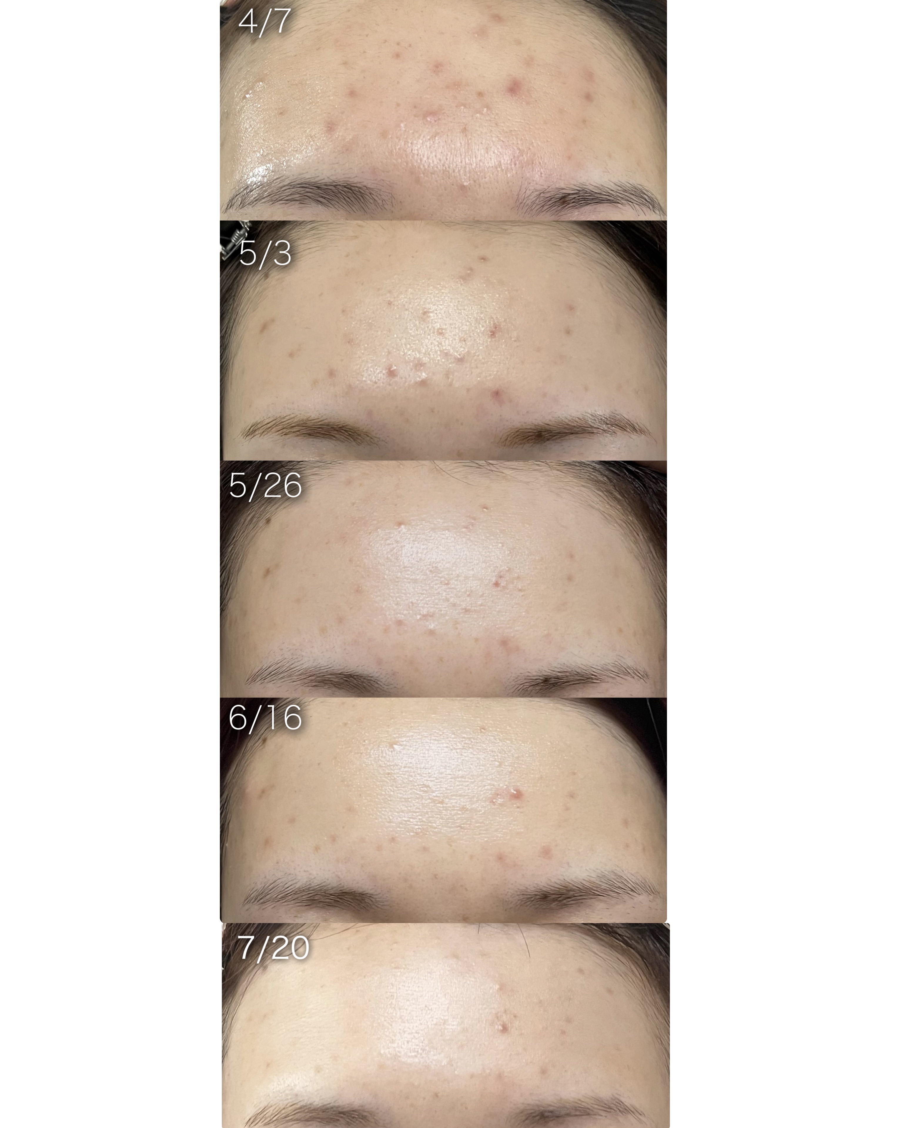 コンブチャ80%トリートメント/DERMA FACTORY/化粧水を使ったクチコミ（2枚目）