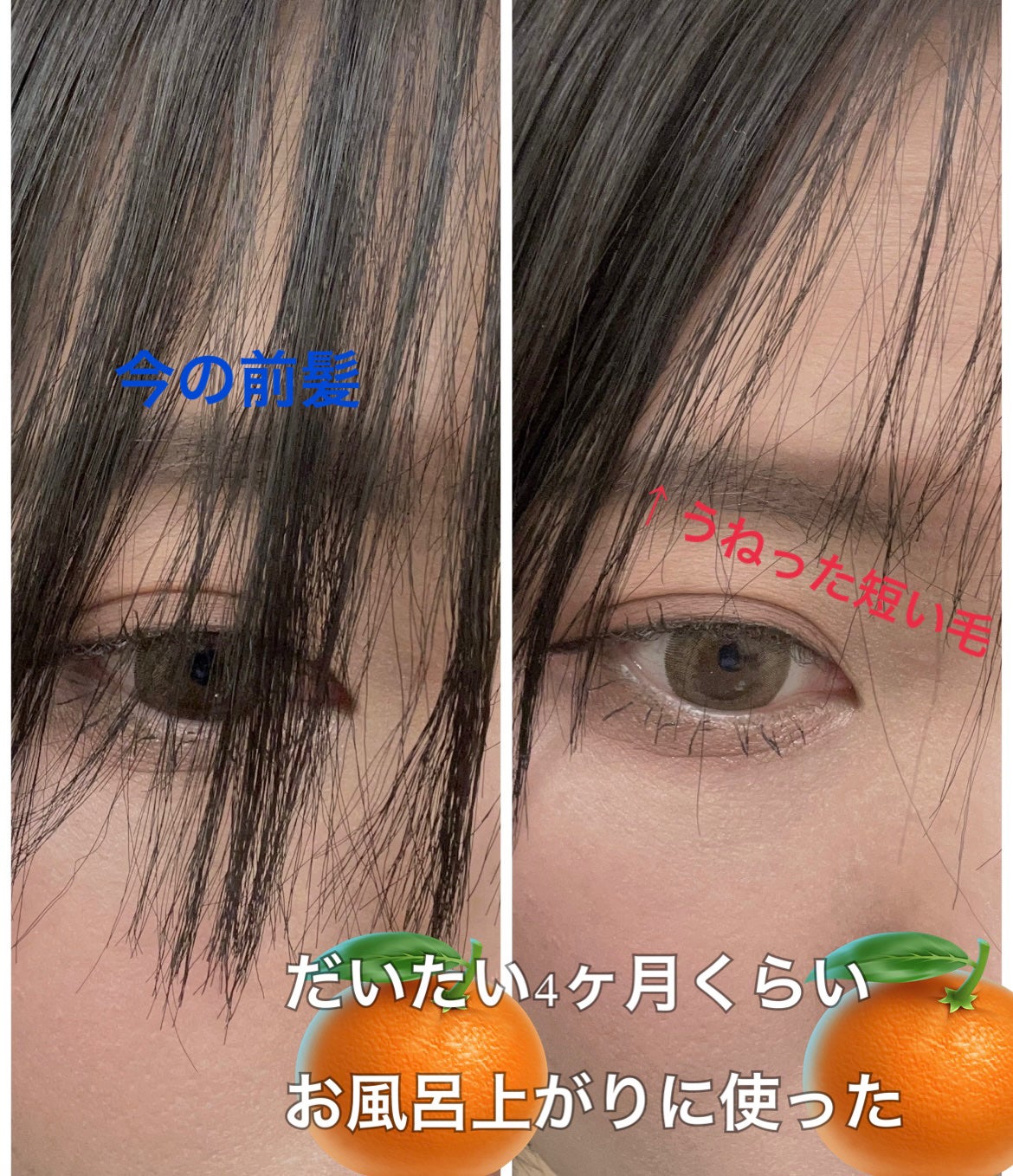 エナジャイザー フォリクル スティミュレーター/HOBE LABS/頭皮ローションを使ったクチコミ(4枚目)