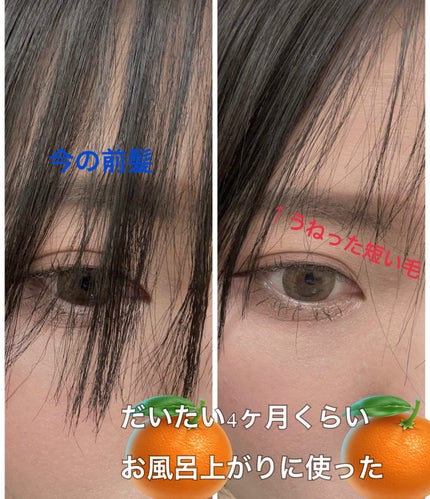 エナジャイザー フォリクル スティミュレーター/HOBE LABS/頭皮ローションを使ったクチコミ(4枚目)