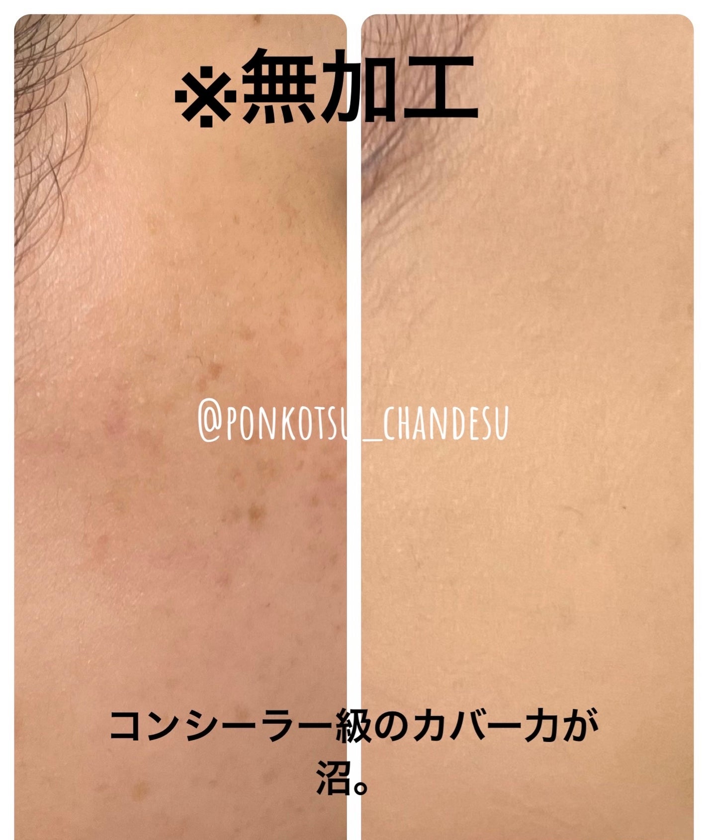 タンイドル ウルトラ ウェア リキッド/LANCOME/リキッドファンデーションを使ったクチコミ(1枚目)