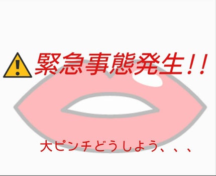 DHC 薬用リップクリーム/DHC/リップクリームを使ったクチコミ(1枚目)