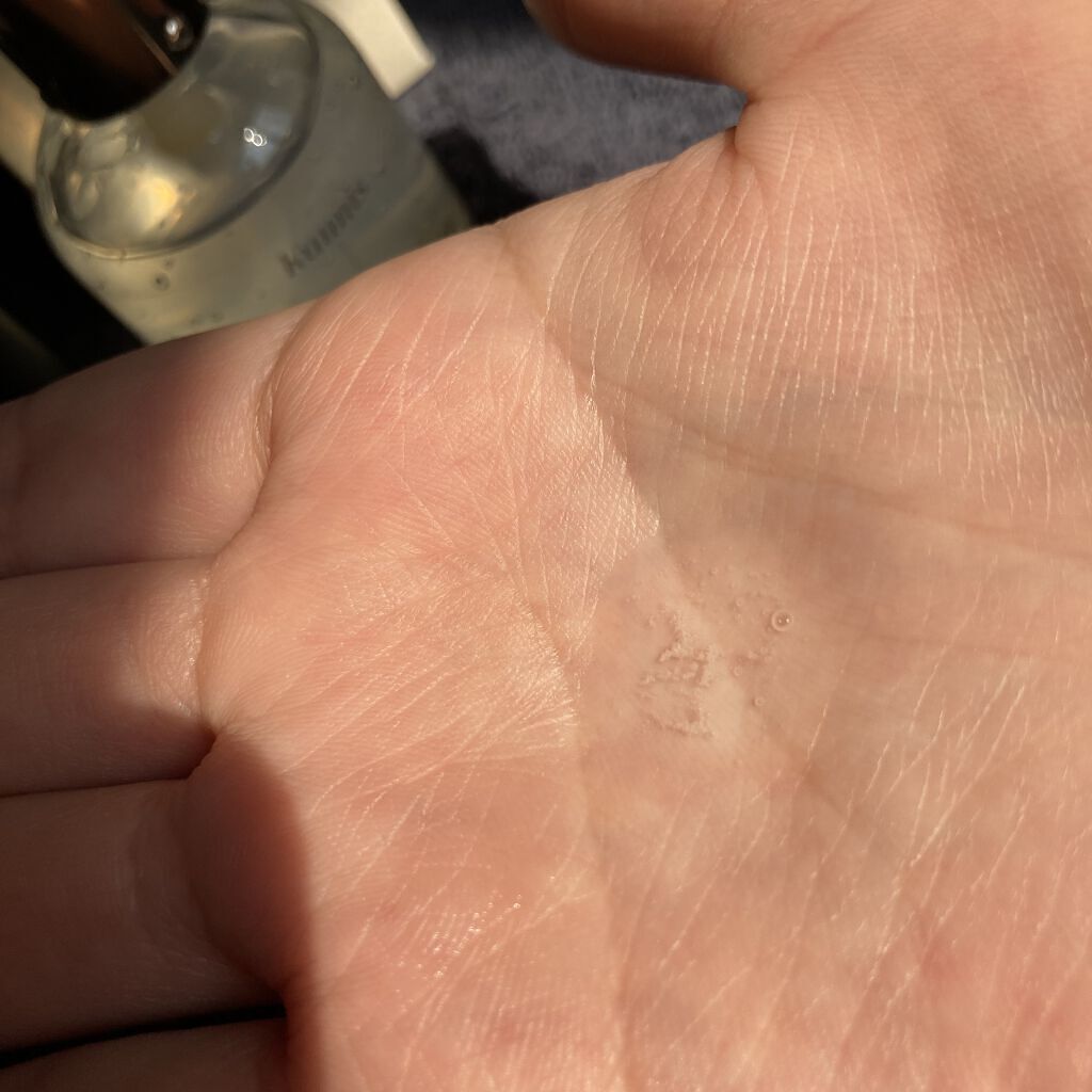 マイクロバイオームテカエッセンシャルスキン/KAUNIS/化粧水を使ったクチコミ（3枚目）