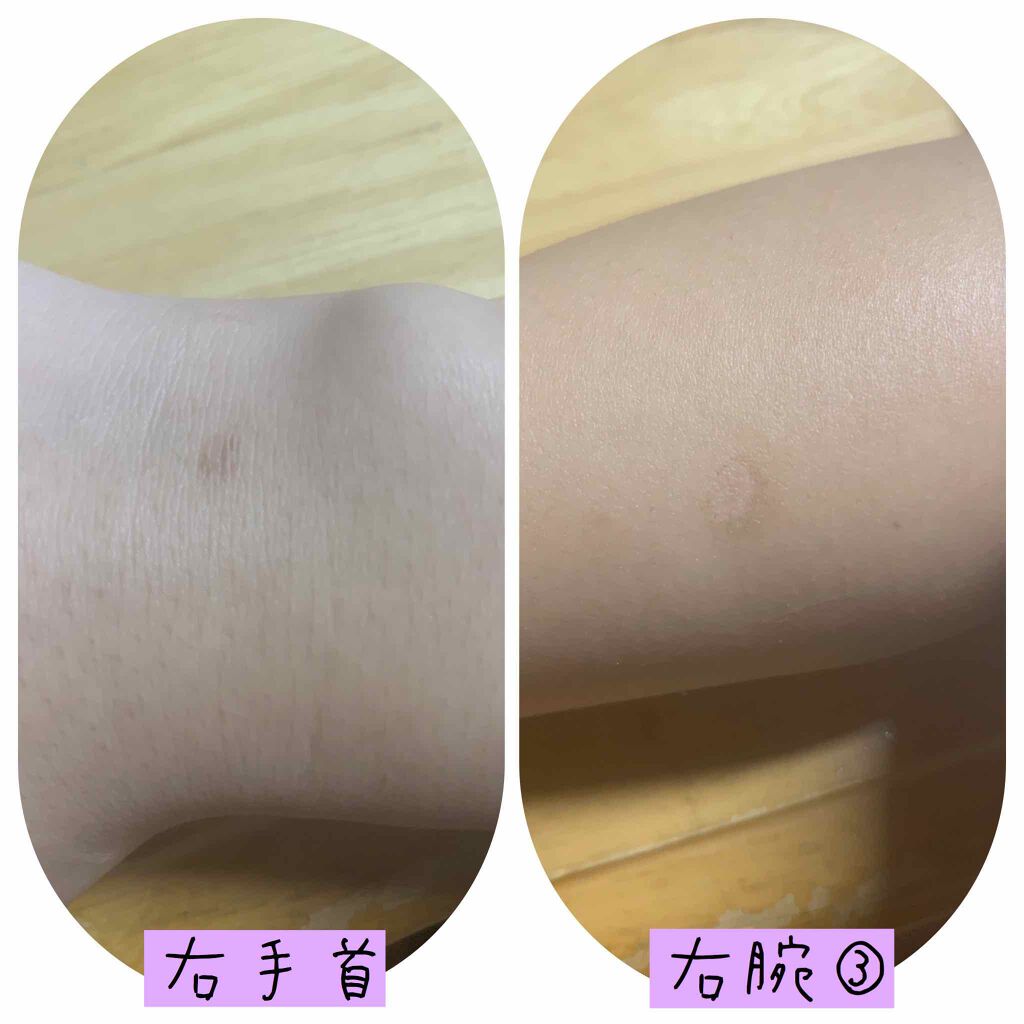 バイオイル/バイオイル/フェイスオイルを使ったクチコミ（3枚目）