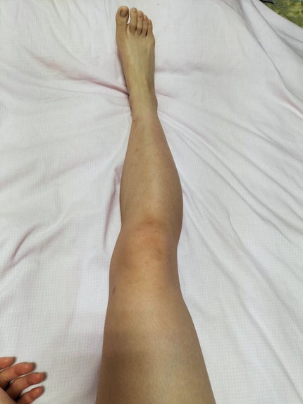 momo ෆ on LIPS 「ひなちゃんねる様の脚やせ動画、昨日は2日目でした。昨日は股関節..」(3枚目)