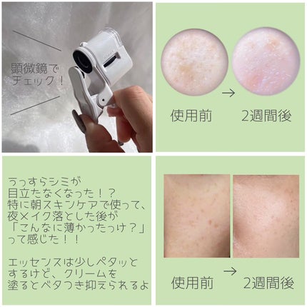 リードルショット300/VT/美容液を使ったクチコミ(8枚目)